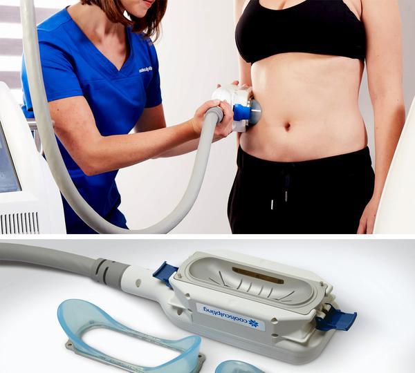 CoolSculpting and SculpSure