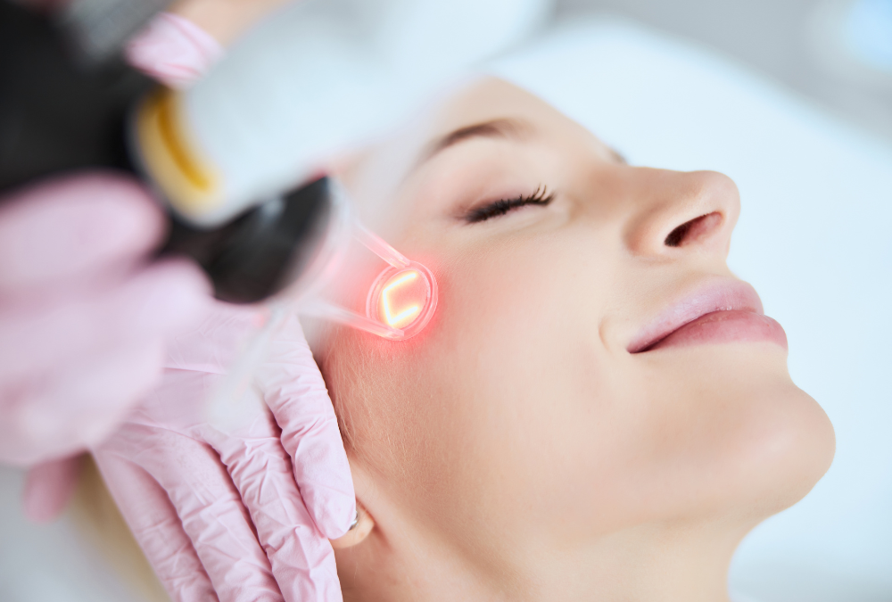 laser skin resurfacing