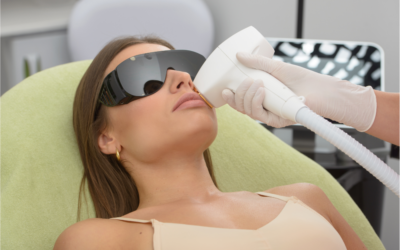 IPL Treatment: 9 Reasons Why It’s a Must for Everyone