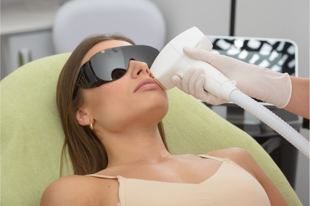 IPL Treatment: 9 Reasons Why It’s a Must for Everyone