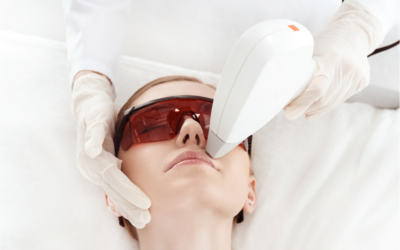 Laser Facials: The Comprehensive Q&A Guide You’ve Been Seeking