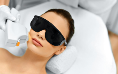 What Is the Best Laser Treatment for Age Spots in 2024?